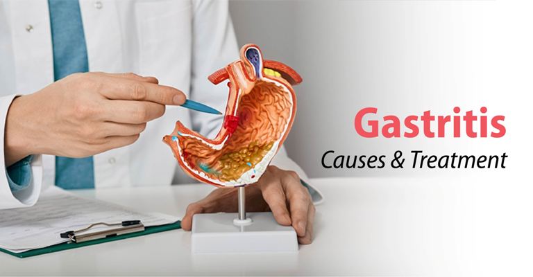 Gastritis treatment
